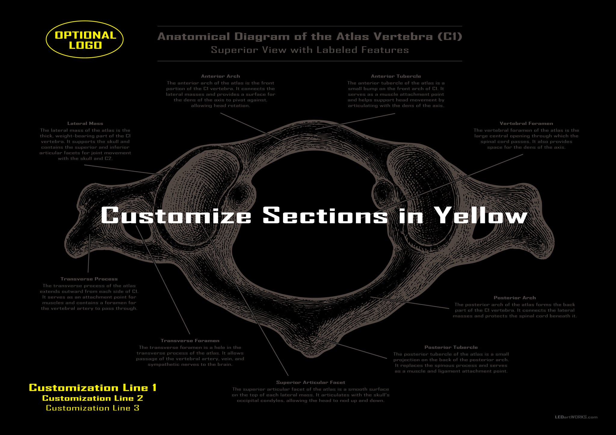Anatomical Diagram of the Atlas Vertebra (C1) – Illuminated Chiropractic Wall Art