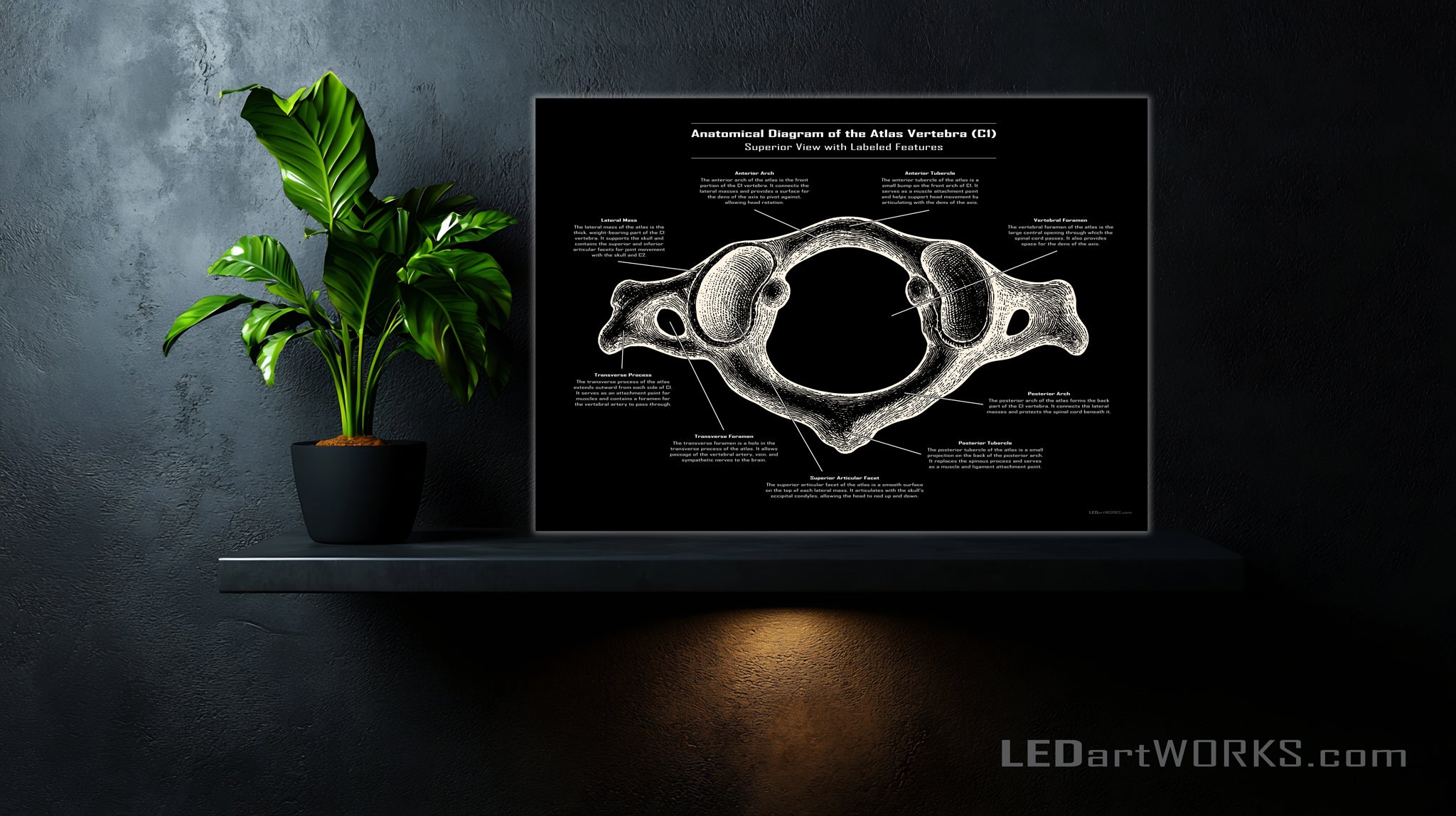 Anatomical Diagram of the Atlas Vertebra (C1) – Illuminated Chiropractic Wall Art